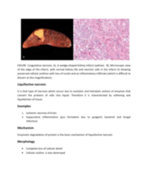 SOLUTION: Necrosis and types of necrosis - Studypool