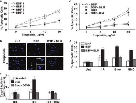 Bs Cells Are Sensitive To Dna Damaging Agents A Etoposide