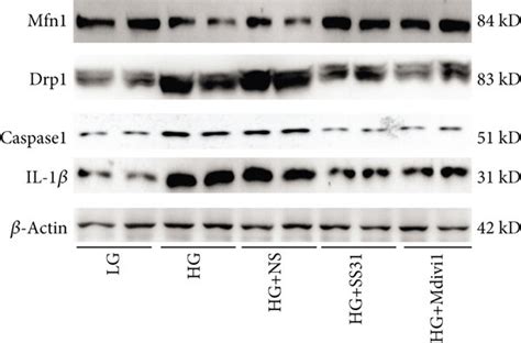 Effects Of Ss31 On Drp1 Mfn1 Caspase1 And Il 1β Protein Expression