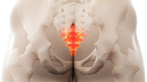 Treating Tailbone Pain — GROW PT