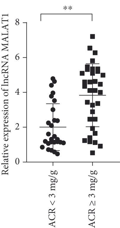 a Association of LncRNA MALAT1 levels with the degree of urine β2