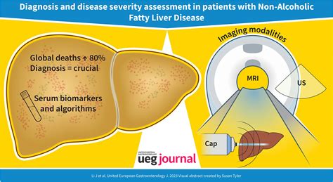 Diagnosis And Assessment Of Disease Severity In Patients With Nonalcoholic Fatty Liver Disease