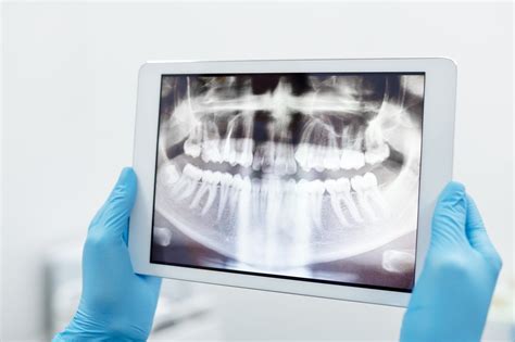 Dental 3D Scanner From Shining 3D - 3D Scanning Services