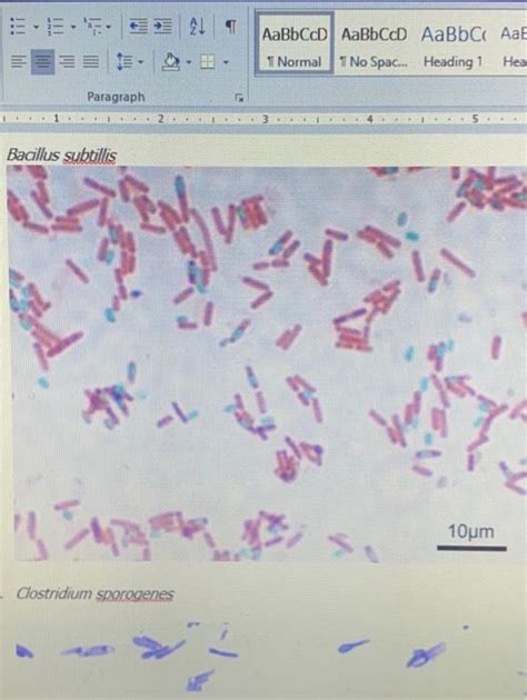 Solved Lab Report The Endospore Stain Name Team Due On Chegg