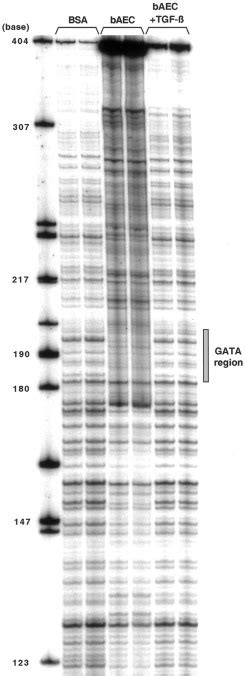 Transforming Growth Factor Mediated Inhibition Of The Flk Kdr Gene