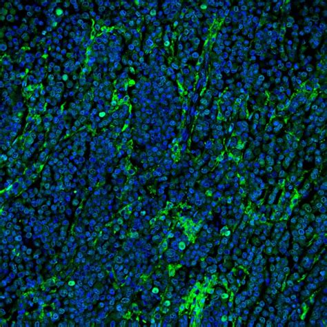 Human Ccr3 Antibody Mab155 100 Randd Systems