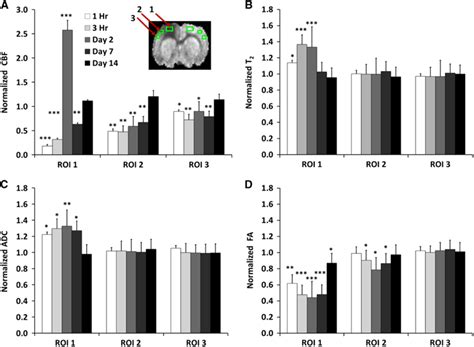 Normalized A Cerebral Blood Flow B T2 C Apparent Diffusion