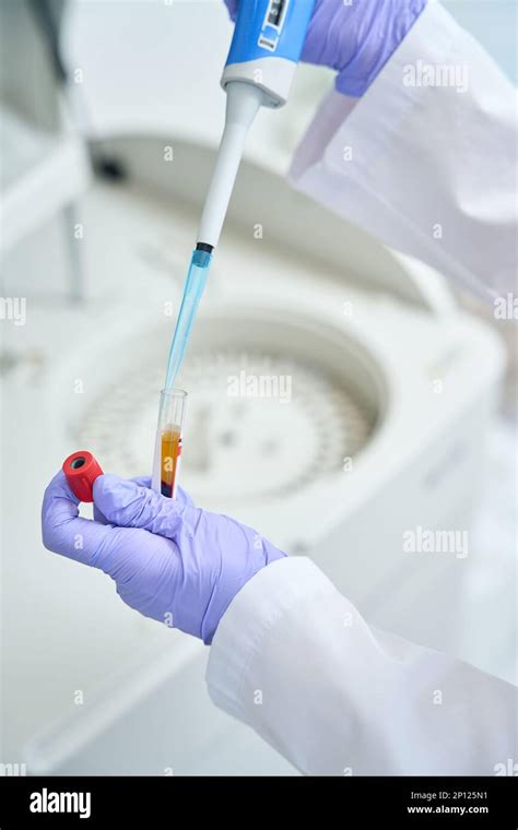 Laboratory Employee Prepares A Biomaterial For Loading Into Biochemical