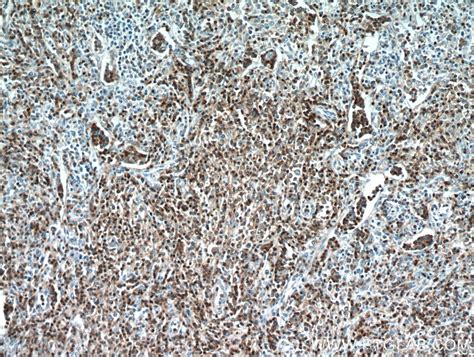 CD3 Antibody 17617-1-AP | Proteintech