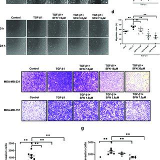 Sfn Inhibits Tgf Induced Migration And Invasion Of Mda Mb And