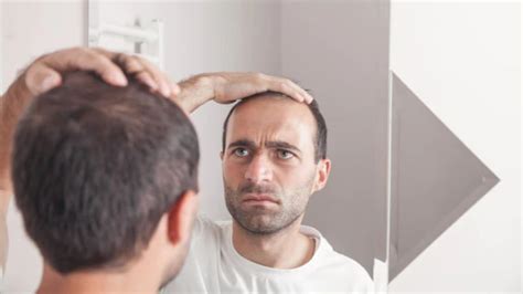 Minoxidil For Men: An Overview