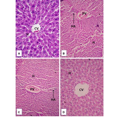 Microphotograph Of Liver Sections Stained With Hematoxylin And Eosin A Download Scientific