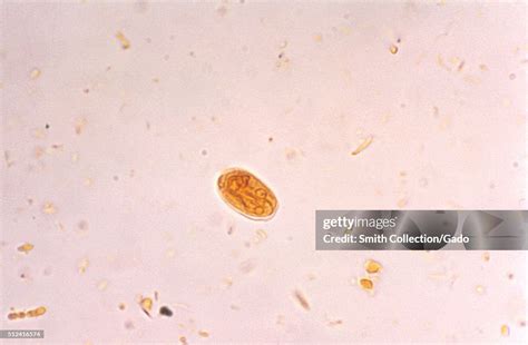 Photomicrograph Of A Giardia Lamblia Cyst Visualized Using An Iodine News Photo Getty Images