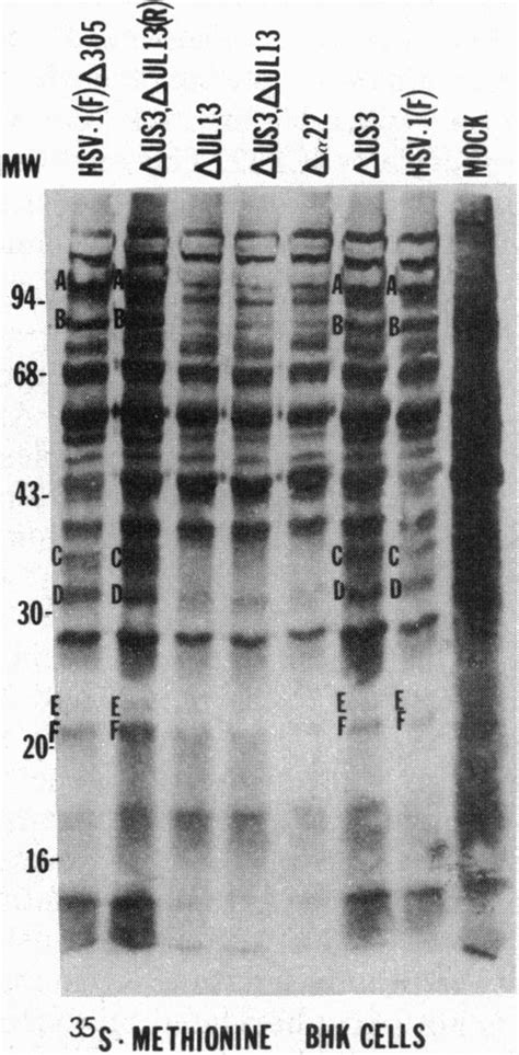 Autoradiographic Image Of Electrophoretically Separated S Labeled