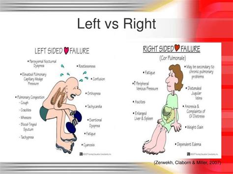 PPT - Congestive Heart Failure PowerPoint Presentation - ID:3114181