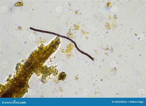 Fungi Hyphae Growing in a Healthy Soil on a Farm Stock Photo - Image of composting ...