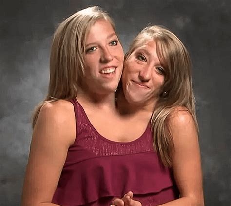 Conjoined Twins Abby And Brittany Hensel See Comments For More Info Frickin Amazing Rfrickin