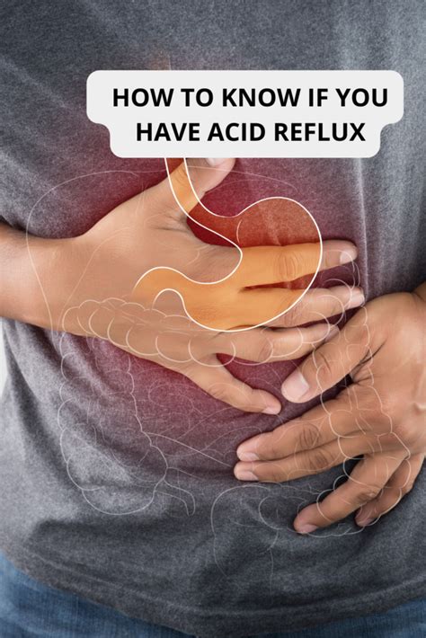 Acid Reflux Symptoms Simply Noel