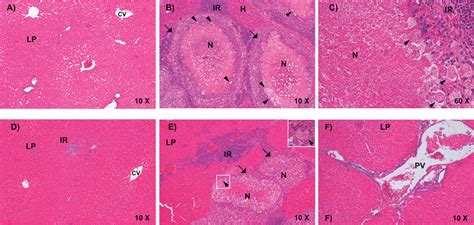 Histopathology Of Amoebic Liver Abscesses 04 μm Sections Of Hamsters Download Scientific