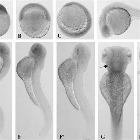 Spatiotemporal Expression Of Abcc1 Gene During Embryogenesis Of