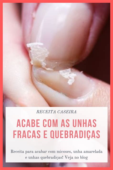 Quer Unhas Fortes E Longas Use Bicarbonato De S Dio