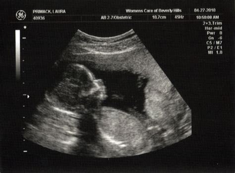 Our Little Munchkin 16 Week Ultrasound