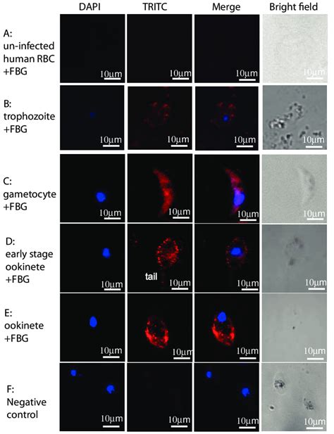 Insect Cell Expressed Recombinant FREP1 FBG Protein Interacts With