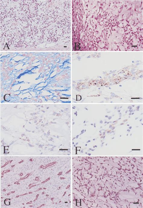 Photograph Showing Hematoxylin And Eosin Staining A B Alcian Blue