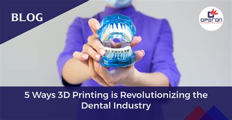 5 Ways Dental 3d Printing Is Changing Dentistry Revolutionizing