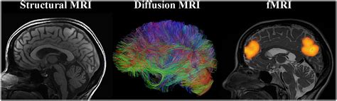 Frontiers Training Induced Neural Plasticity In Youth A Systematic