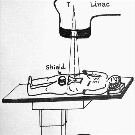 Front View Of The Top And Bottom Parts Of The Gonadal Shield The