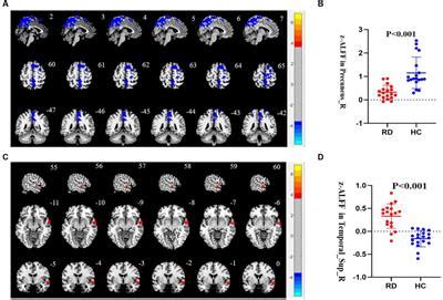 Frontiers Altered Functional Activity Of The Precuneus And Superior