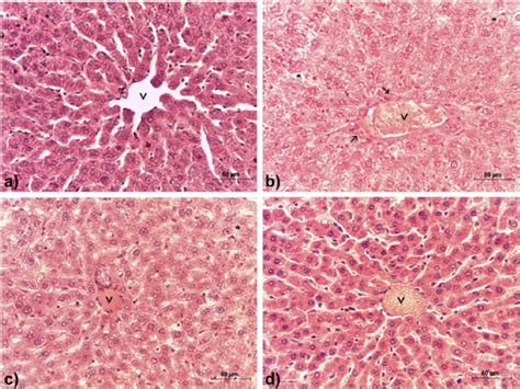 Light Micrographs Of Liver Sections A Normal Hepatocytes And