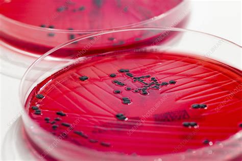 Salmonella Enterica Culture On Xld Agar Stock Image C0291360