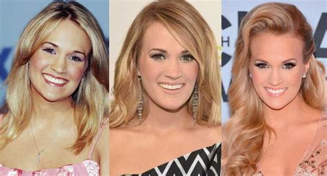 Carrie Underwood Plastic Surgery 2023 Famousfaceshub