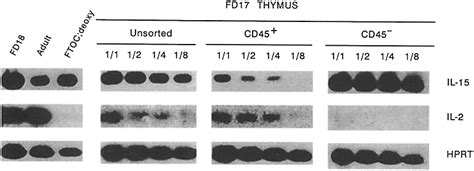 Il 15 And Il 2 Mrna Expression In Thymus Left Il 15 Il 2 And Hprt