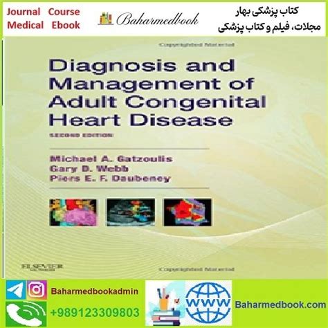 Diagnosis And Management Of Adult Congenital Heart Disease