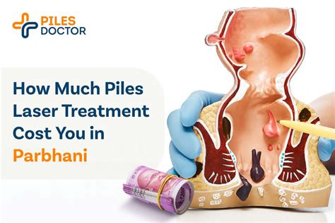 Piles Laser Treatment Cost In Parbhani Operation Cost Piles Doctor