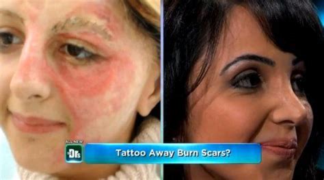 Woman Transforms Her Facial Burns Scar With Tattoo Ink And Now Helps Others Do The Same