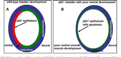 Figure 2 From New Insights Into The Pathogenesis Of Bladder Exstrophy Epispadias Complex