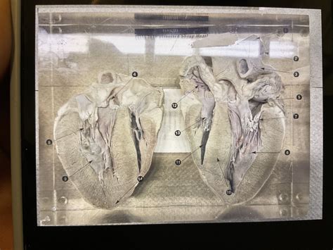 Sheep Heart Diagram Quizlet