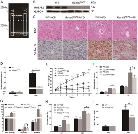 Rasal2 Deficiency Attenuates Hepatic Steatosis By Promoting Hepatic