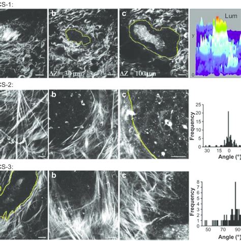 Tacs Collagen Fiber Alignment Characterization Of The Mmtv Pymt Breast