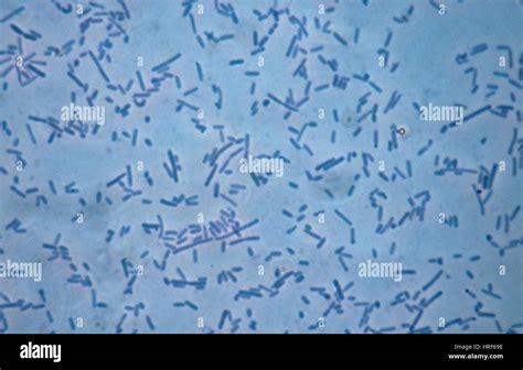 Pseudomonas Aeruginosa Skin