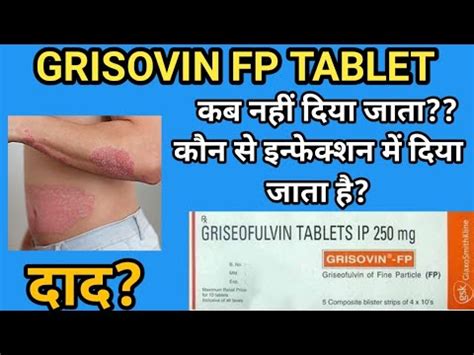 Grisovin Tablets Griseofulvin Tablet Griseofulvin 250mg Tablet Uses