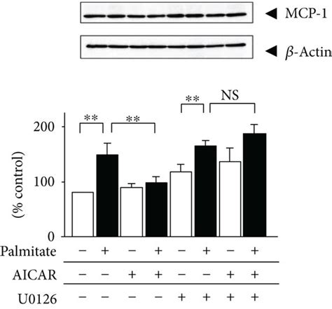 Effects Of Compound C And U126 On MCP 1 In Palmitate Preloaded 3T3 L1