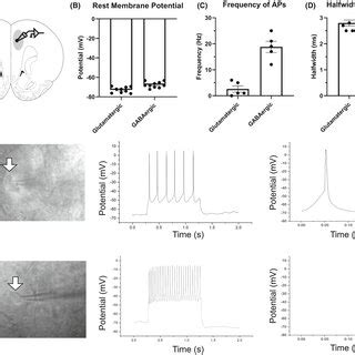 Electrophysiological Properties Of Putative Glutamatergic And Gabaergic