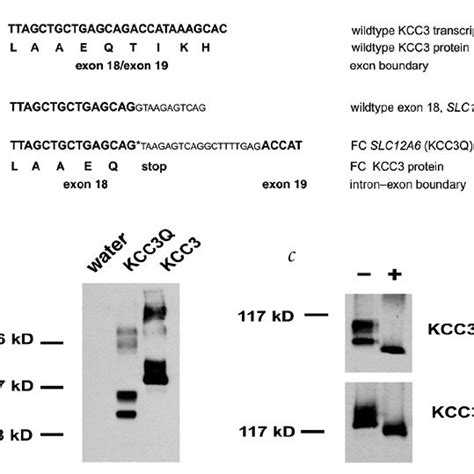 Immunoblotting Of Wildtype And Mutant Kcc3 Proteins A Top Sequence