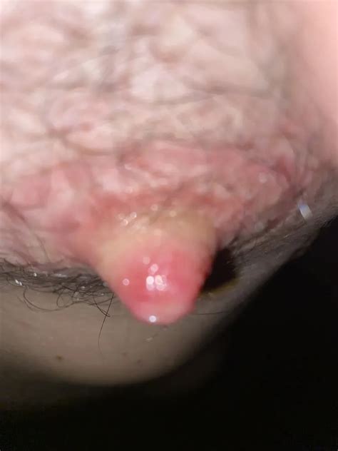 Supple Cups For The Stretching Nude Pics XHamster