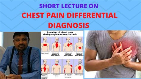 Differential Diagnosis Chest Pain